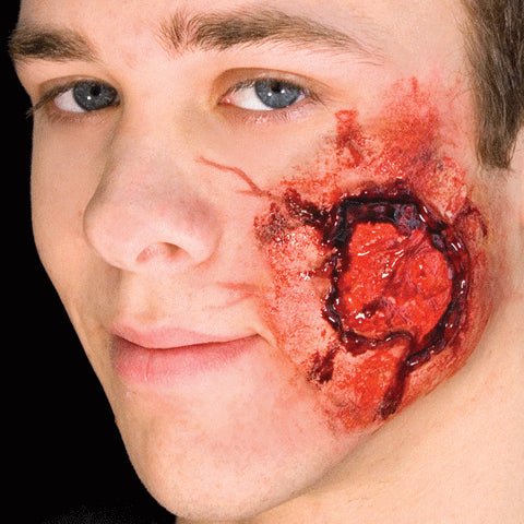 Open Wound with Muscle Tissue Latex Injury