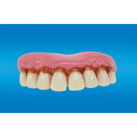 Full Grill Teeth