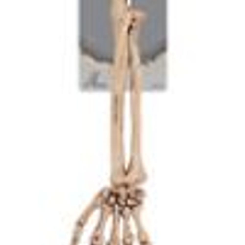 Skeleton Arm 14"