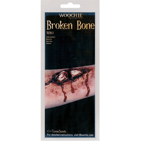 Broken Bone Latex Injury
