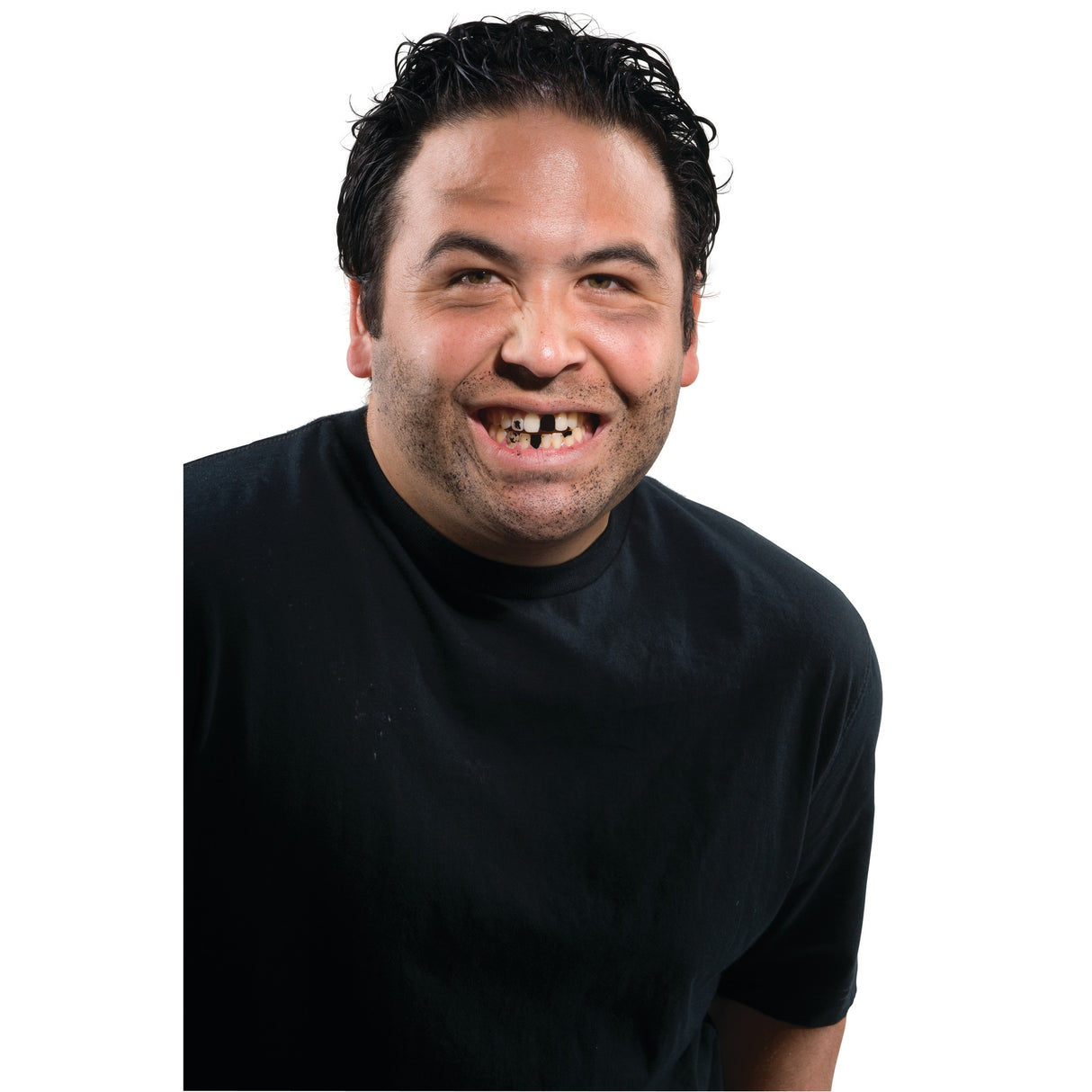 Temporary Tooth