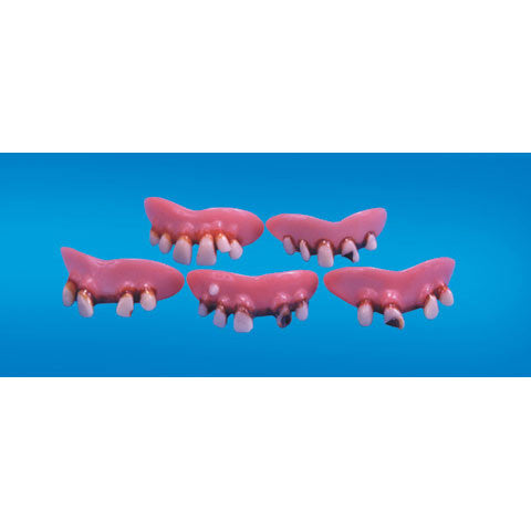 Billy Bob Teeth
